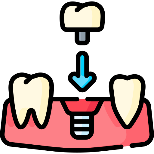 Dr Viral Gada - Dental Implants