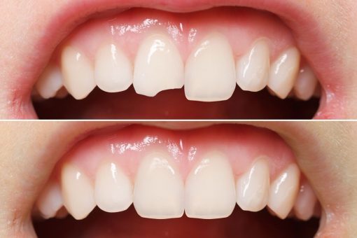 Best Cosmetic Dentistry Doctor in Mulund West 