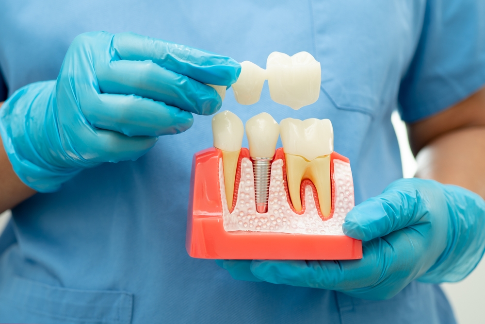 Best Cosmetic Dentistry Doctor in Mulund West, Mumbai