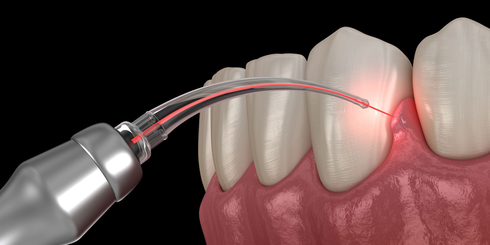 Gum Treatment Doctor in Mulund 