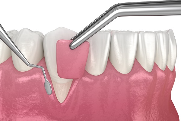 Gum Treatment Doctor in Mulund West