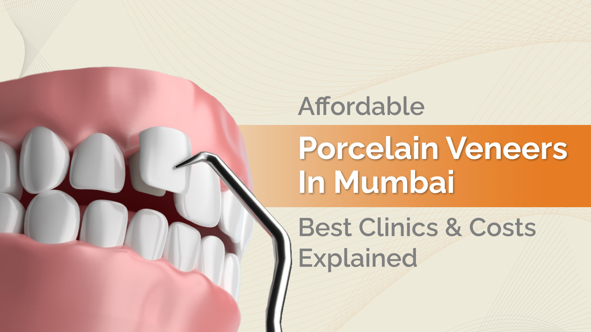 Root Canal