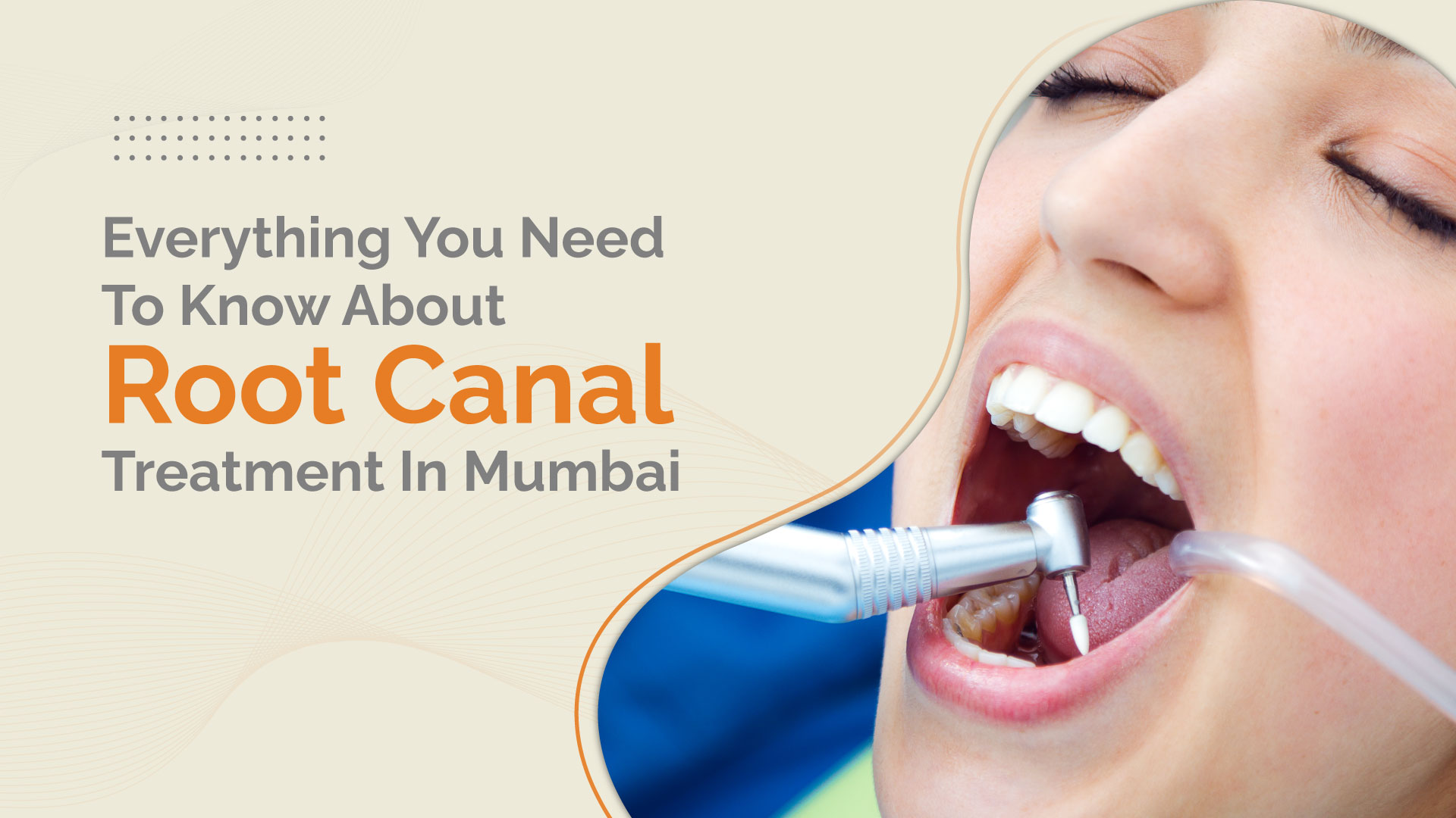 Root Canal